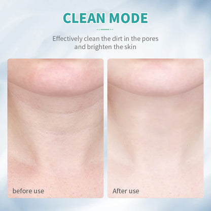 Neck and Face Beauty Device